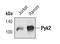 Protein Tyrosine Kinase 2 Beta antibody, PA5-17057, Invitrogen Antibodies, Western Blot image 