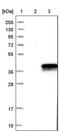 Dehydrodolichyl Diphosphate Synthase Subunit antibody, PA5-55393, Invitrogen Antibodies, Western Blot image 