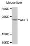 Acid Phosphatase 1 antibody, LS-C408354, Lifespan Biosciences, Western Blot image 