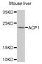 Acid Phosphatase antibody, LS-C408354, Lifespan Biosciences, Western Blot image 