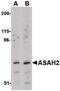 N-Acylsphingosine Amidohydrolase 2 antibody, PA5-20575, Invitrogen Antibodies, Western Blot image 