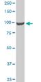 CTD Phosphatase Subunit 1 antibody, H00009150-M04, Novus Biologicals, Western Blot image 