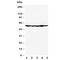 Histone Deacetylase 2 antibody, R30416, NSJ Bioreagents, Western Blot image 