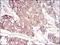Serpin Family A Member 3 antibody, NBP2-52559, Novus Biologicals, Immunohistochemistry frozen image 