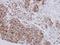 NADH:Ubiquinone Oxidoreductase Subunit B10 antibody, GTX114576, GeneTex, Immunohistochemistry paraffin image 