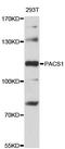 Phosphofurin Acidic Cluster Sorting Protein 1 antibody, LS-C747751, Lifespan Biosciences, Western Blot image 