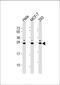 KDEL Endoplasmic Reticulum Protein Retention Receptor 1 antibody, 60-332, ProSci, Western Blot image 