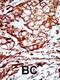 Tyrosine 3-Monooxygenase/Tryptophan 5-Monooxygenase Activation Protein Beta antibody, MBS9202794, MyBioSource, Immunohistochemistry paraffin image 