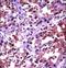 Heat Shock Transcription Factor 1 antibody, LS-C165046, Lifespan Biosciences, Immunohistochemistry paraffin image 