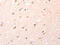 Angiopoietin Like 2 antibody, CSB-PA337817, Cusabio, Immunohistochemistry frozen image 