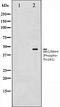 Mitogen-Activated Protein Kinase Kinase 4 antibody, orb106165, Biorbyt, Western Blot image 