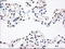 Polo Like Kinase 1 antibody, M00182-1, Boster Biological Technology, Immunohistochemistry paraffin image 