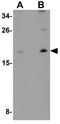 ORMDL Sphingolipid Biosynthesis Regulator 1 antibody, GTX32012, GeneTex, Western Blot image 