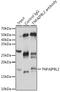 TNF Alpha Induced Protein 8 Like 2 antibody, GTX66198, GeneTex, Immunoprecipitation image 