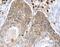 Ring Finger Protein 185 antibody, MBS2525778, MyBioSource, Immunohistochemistry paraffin image 