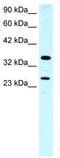 Asialoglycoprotein Receptor 2 antibody, TA334287, Origene, Western Blot image 