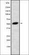 Cholinergic Receptor Nicotinic Beta 4 Subunit antibody, orb338494, Biorbyt, Western Blot image 