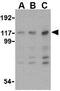 Interferon Induced With Helicase C Domain 1 antibody, GTX31305, GeneTex, Western Blot image 