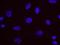 Nibrin antibody, NB100-60654, Novus Biologicals, Proximity Ligation Assay image 