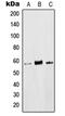 LCK Proto-Oncogene, Src Family Tyrosine Kinase antibody, MBS822038, MyBioSource, Western Blot image 