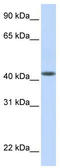 DENN Domain Containing 1B antibody, TA340371, Origene, Western Blot image 