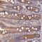 AC022098.1 antibody, NBP1-91122, Novus Biologicals, Immunohistochemistry paraffin image 