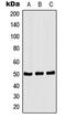 C-Terminal Src Kinase antibody, GTX32169, GeneTex, Western Blot image 