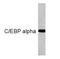 CCAAT Enhancer Binding Protein Alpha antibody, GTX15047, GeneTex, Western Blot image 