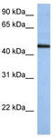 Zinc Finger Protein 766 antibody, TA342126, Origene, Western Blot image 