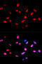 RB Transcriptional Corepressor 1 antibody, MBS126008, MyBioSource, Immunofluorescence image 