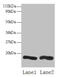 Charged Multivesicular Body Protein 2A antibody, CSB-PA04524A0Rb, Cusabio, Western Blot image 