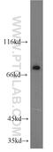 Potassium Two Pore Domain Channel Subfamily K Member 5 antibody, 14136-1-AP, Proteintech Group, Western Blot image 