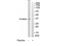Fc Fragment Of IgG Receptor IIc (Gene/Pseudogene) antibody, TA326274, Origene, Western Blot image 