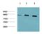 Protein Kinase AMP-Activated Catalytic Subunit Alpha 1 antibody, GTX34142, GeneTex, Western Blot image 