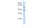 Solute Carrier Family 25 Member 16 antibody, GTX46765, GeneTex, Western Blot image 