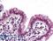 SWI/SNF Related, Matrix Associated, Actin Dependent Regulator Of Chromatin, Subfamily B, Member 1 antibody, LS-B6039, Lifespan Biosciences, Immunohistochemistry paraffin image 