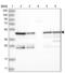 Protein Phosphatase 1 Regulatory Subunit 7 antibody, NBP2-38207, Novus Biologicals, Western Blot image 