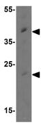 MCL1 Apoptosis Regulator, BCL2 Family Member antibody, GTX31708, GeneTex, Western Blot image 