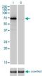 Coagulation Factor II, Thrombin antibody, H00002147-M01, Novus Biologicals, Western Blot image 