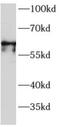 Myocyte Enhancer Factor 2D antibody, FNab05108, FineTest, Western Blot image 