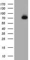 Angiotensin I Converting Enzyme 2 antibody, LS-C790043, Lifespan Biosciences, Western Blot image 