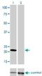 Myosin Light Chain 1 antibody, H00004632-M01, Novus Biologicals, Western Blot image 