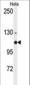 Actinin Alpha 4 antibody, LS-C96726, Lifespan Biosciences, Western Blot image 