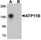ATPase Phospholipid Transporting 11B (Putative) antibody, PA5-20996, Invitrogen Antibodies, Western Blot image 