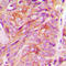 Golgi Reassembly Stacking Protein 2 antibody, LS-C353383, Lifespan Biosciences, Immunohistochemistry paraffin image 