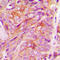 Golgi reassembly-stacking protein 2 antibody, LS-C353383, Lifespan Biosciences, Immunohistochemistry paraffin image 