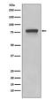 Trophoblast Glycoprotein antibody, M07442, Boster Biological Technology, Western Blot image 