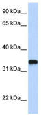 Hyaluronan Synthase 3 antibody, TA339007, Origene, Western Blot image 