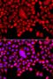 Tyrosyl-DNA Phosphodiesterase 1 antibody, PA5-76319, Invitrogen Antibodies, Immunofluorescence image 