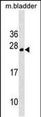 TPD52 Like 1 antibody, PA5-49076, Invitrogen Antibodies, Western Blot image 